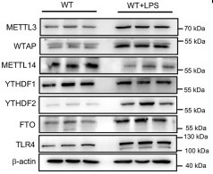 Immunoblot analysis of METTL3 and other m6A-related protein expressions.jpg